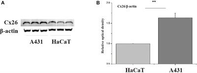 Connexin26 Modulates the Radiosensitivity of Cutaneous Squamous Cell Carcinoma by Regulating the Activation of the MAPK/NF-κB Signaling Pathway